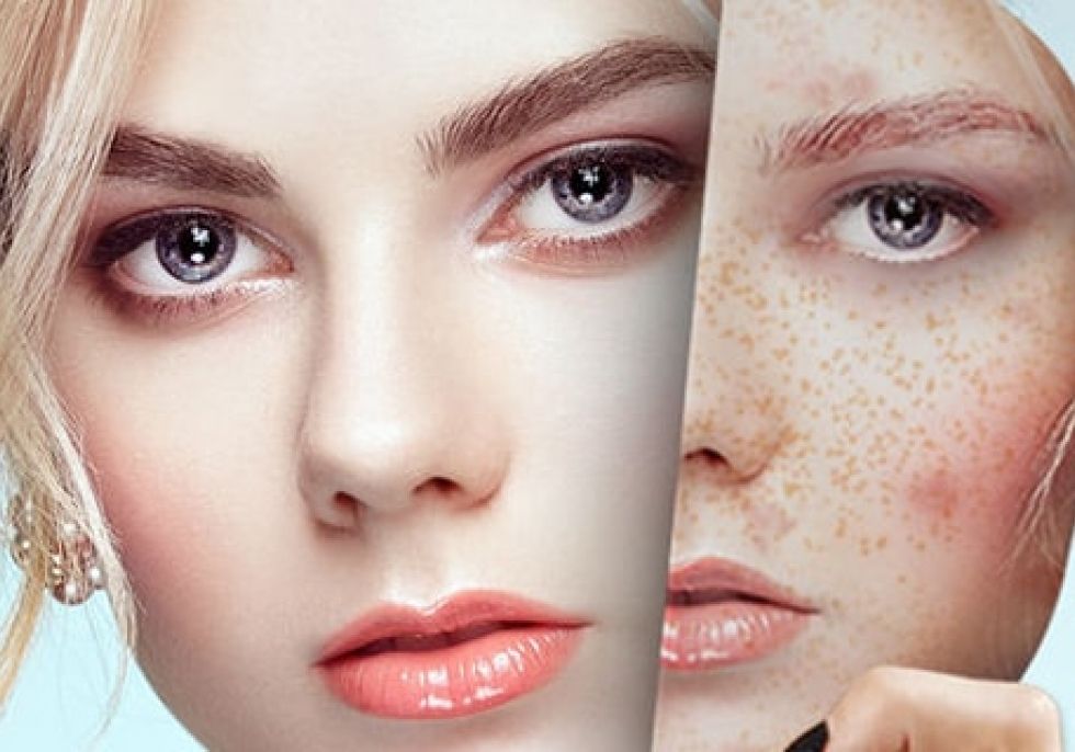 Phytopeeling Phytopeeling