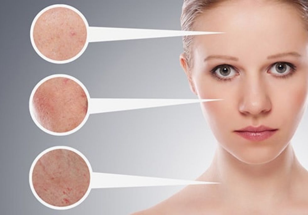 Βαθύς καθαρισμός για Ακμή Βαθύς καθαρισμός για Ακμή